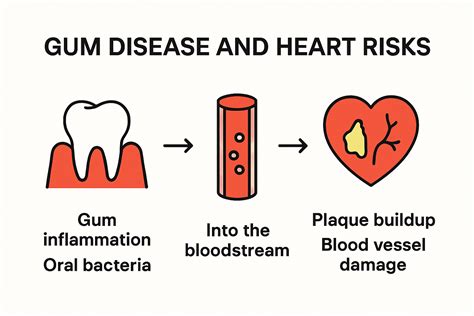 The Connection Between Gum Disease And Heart Issues