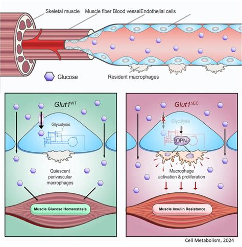 The Connection Between Muscle Mass And Insulin Sensitivity