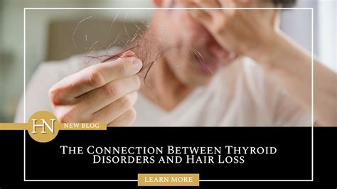 The Connection Between Thyroid Health And Hair Loss