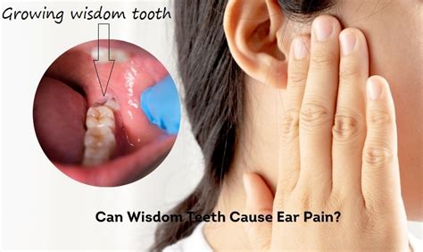 The Connection Between Wisdom Teeth and Ear Pain