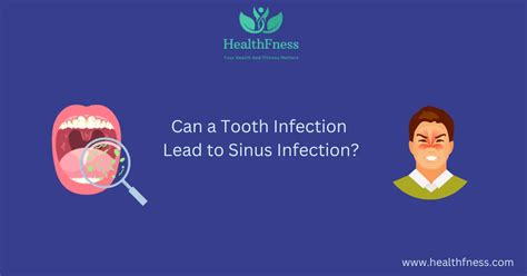 The Connection How a Tooth Infection Affects Your Throat