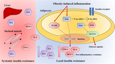 The Connection: Type 2 Diabetes and Chronic Inflammation