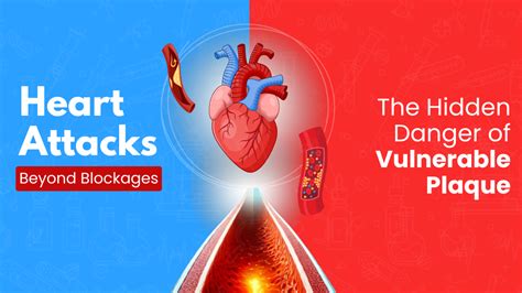 The Danger of Blockages