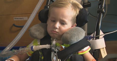 The Devastating Impact of Polio