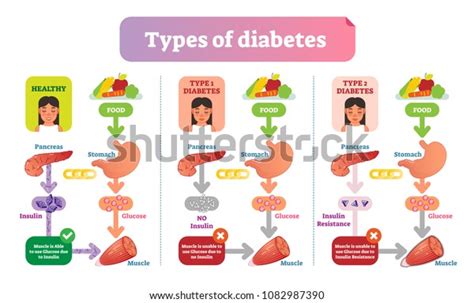 The Different Types of Basic Diabetes