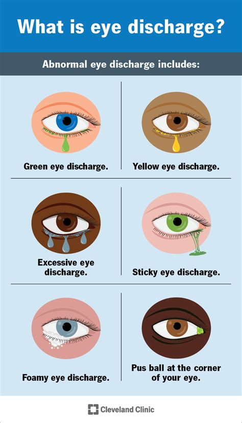 The Different Types of Eye Discharge