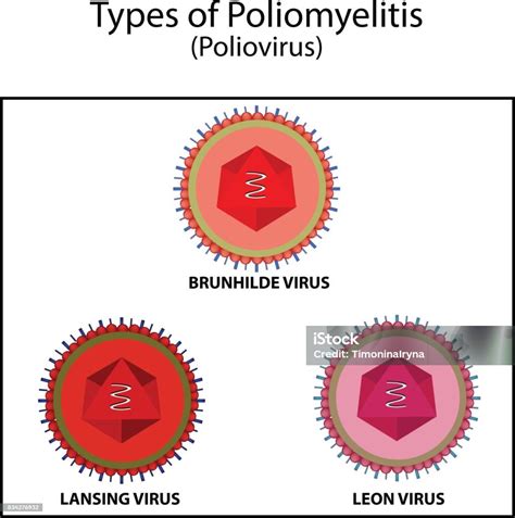 The Different Types of Poliovirus