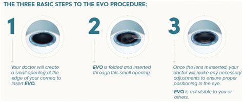 The Evo Procedure: Step-by-Step