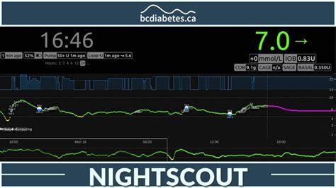 The Future of Nightscout