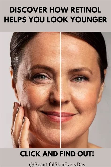 The Incredible Benefits of Using Retinol Cream