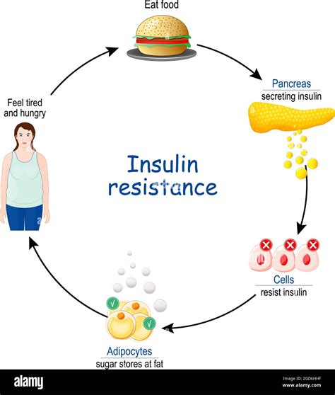 The Insulin Resistance Connection