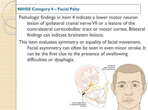 The Interplay of NIHSS and Facial Palsy