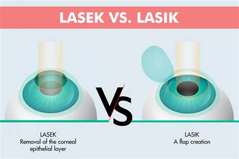 The LASIK Difference