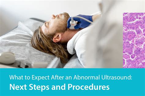 The Next Steps After an Abnormal X-Ray