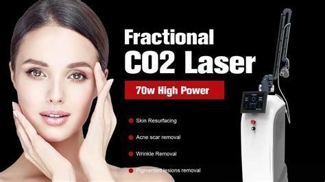 The Number of Sessions You Need