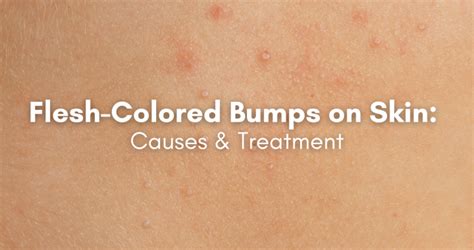 The Problem with the Old "Flesh" Color