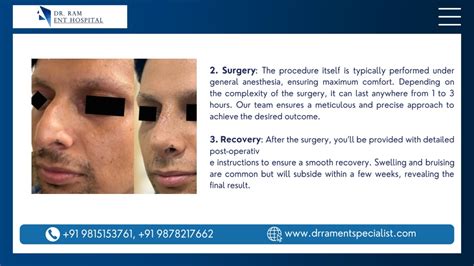 The Procedure Itself What to Expect