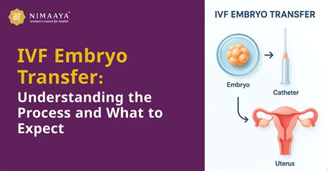 The Process What to Expect