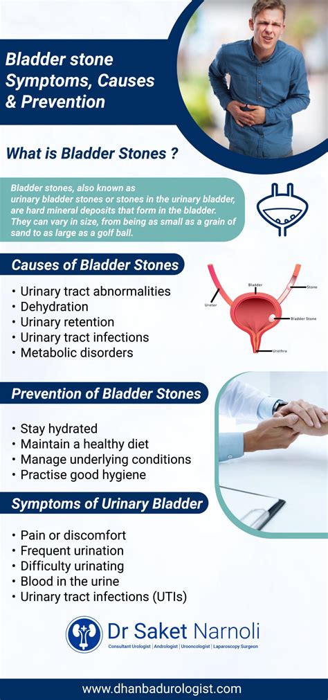 The Science Behind Bladder Stone Prevention