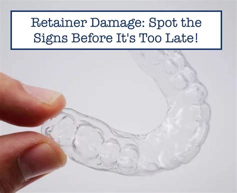 The Sticky Situation Damage to Your Retainer