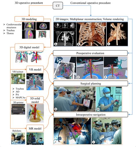 The Surgical Procedure Visualized
