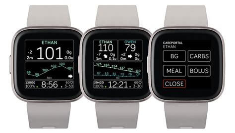 The Technology Behind Nightscout