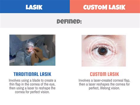 The Technology Used (Standard vs. Custom LASIK)