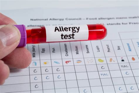 The Types of Food Allergy Tests Available