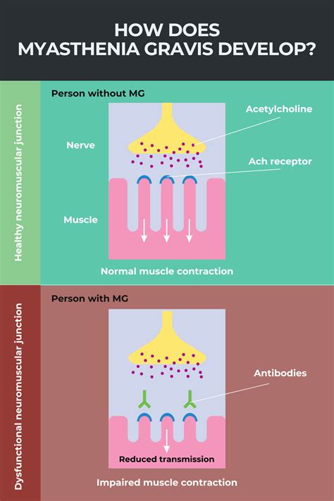 https://tse1.mm.bing.net/th?q=The Underlying Battle: Antibodies vs. Communication