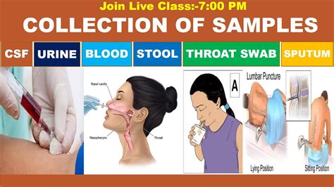Throat Swabs & CSF Analysis