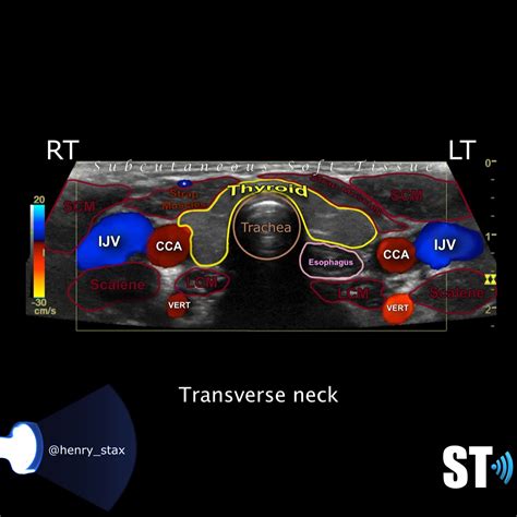 Thyroid