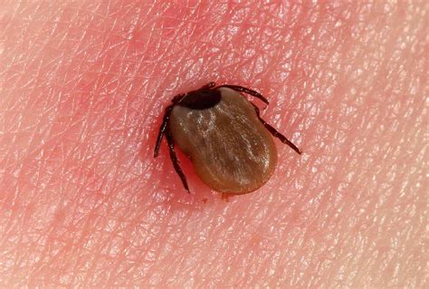 Candid clicks of Tick on Skin: Uncensored images that reveal the intimate details of tick infestations