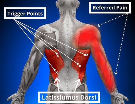 Tight Lats Shoulder Pain