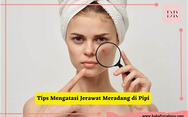 Tips Jerawat Meradang