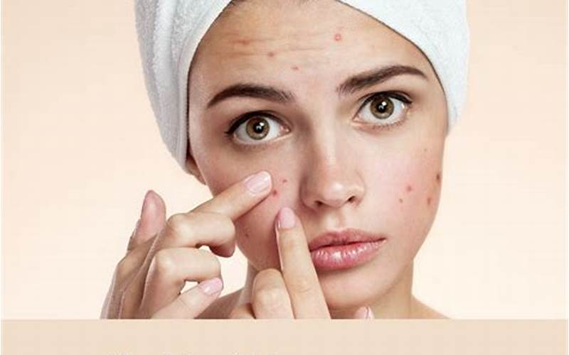 Tips to Treat Acne