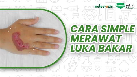 Tips Dan Cara Bagaimana Menghilangkan Bekas Luka Bakar Setrika