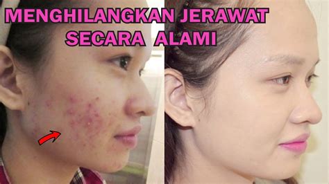 Tips Dan Cara Bagaimana Menghilangkan Face Fat