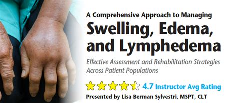 Tips for Managing Swelling at Home