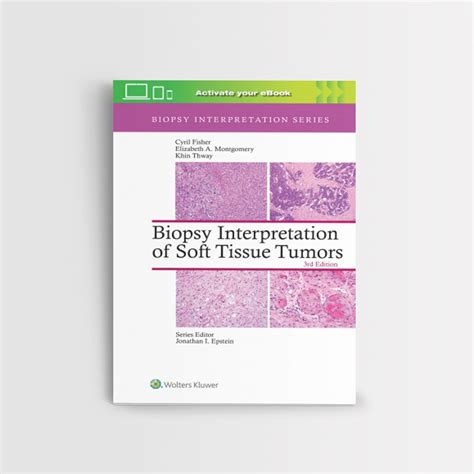 Tissue Biopsy Test and interpretation