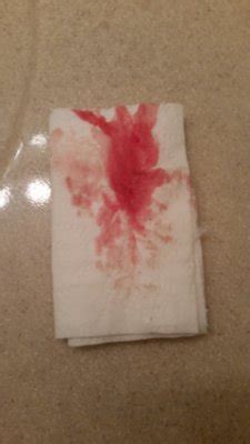 Toilet Paper Implantation Bleeding Texture