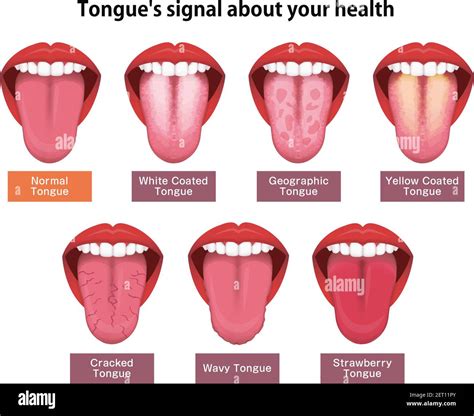 Tongue Color: Decode Your Health Secrets.