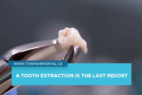Tooth Extraction: A Last Resort