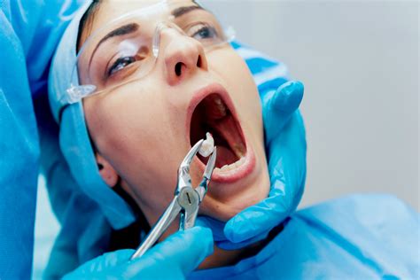 Tooth Extraction by a Dentist