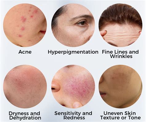 Top Picks for Different Skin Concerns