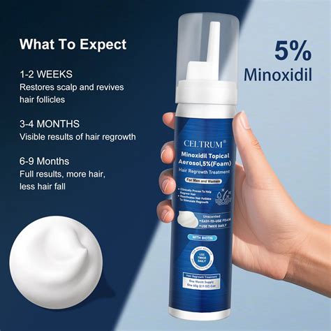 Topical Minoxidil Application