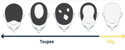 Toupee vs. Wig: Understanding the Difference