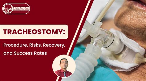 Tracheostomy: Procedure, Risks, & What You Need to Know.