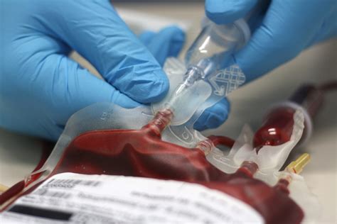 Transfusion Safety Areas