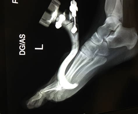 Traumatic Injuries and Foreign Objects