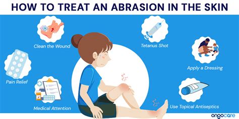 Treating Abrasions: Fast Healing & Scar Prevention